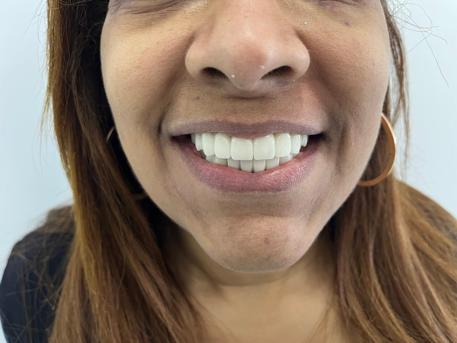 Mutlu hastalar ve diş kliniği personeli Türkiye